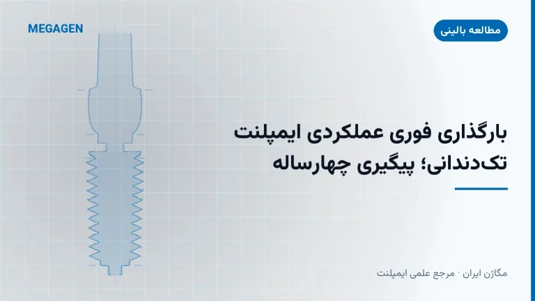 بارگذاری فوری عملکردی ایمپلنت تکدندانی؛ پیگیری چهارساله