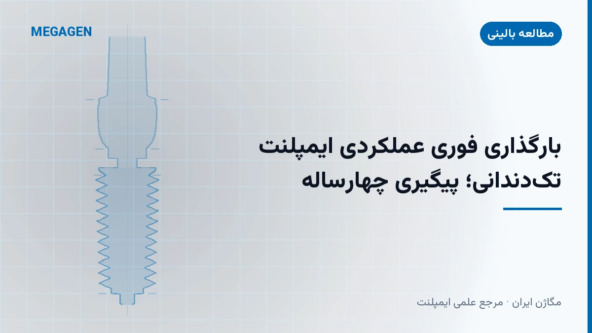 بارگذاری فوری عملکردی ایمپلنت تک‌دندانی؛ پیگیری چهارساله