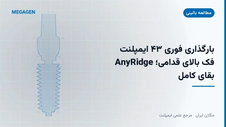 بارگذاری فوری ۴۳ ایمپلنت AnyRidge فک بالای قدامی؛ بقای کامل