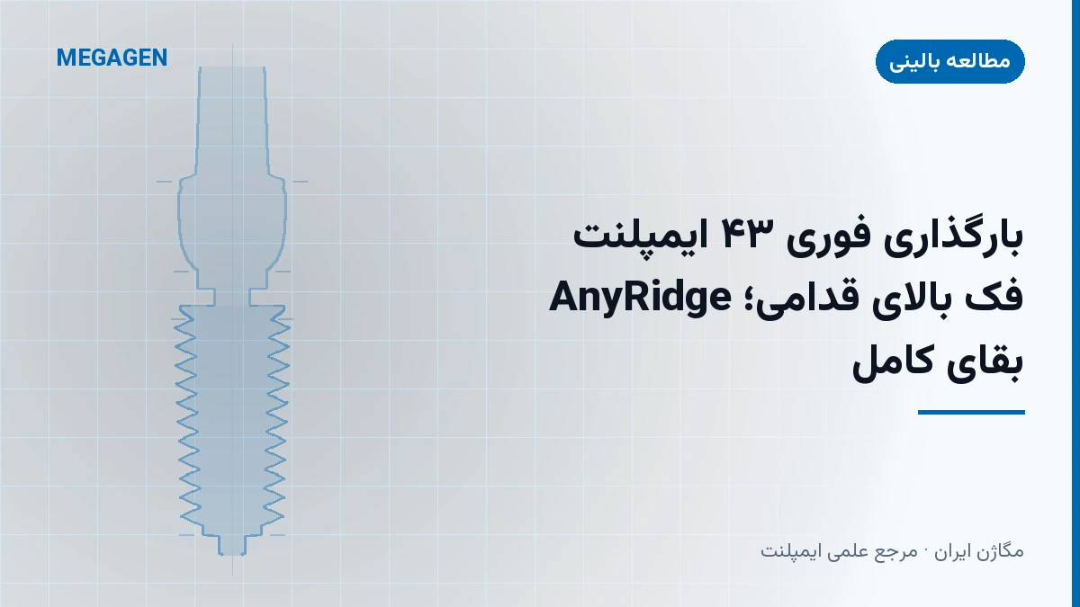بارگذاری فوری ۴۳ ایمپلنت AnyRidge فک بالای قدامی؛ بقای کامل