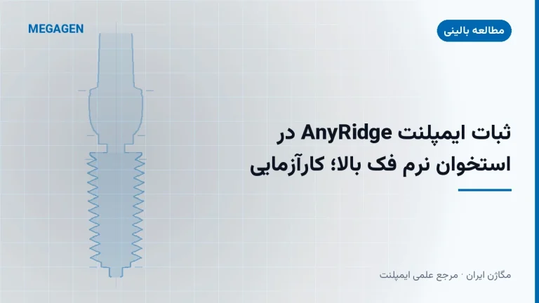 ثبات ایمپلنت AnyRidge در استخوان نرم فک بالا؛ کارآزمایی