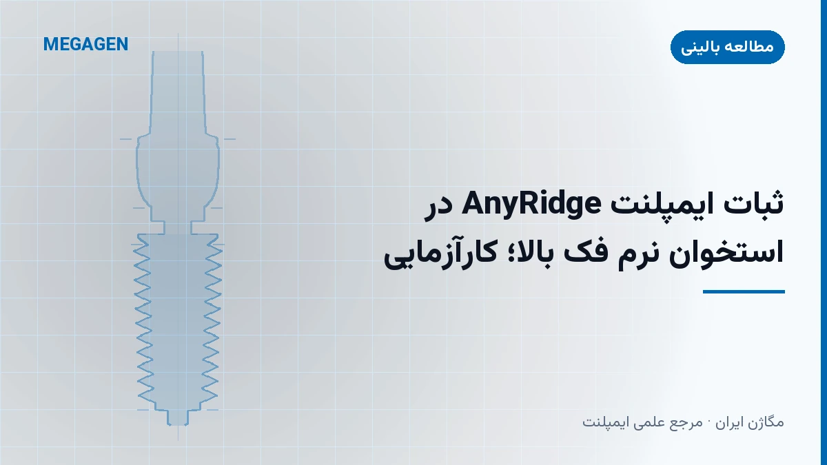 ثبات ایمپلنت AnyRidge در استخوان نرم فک بالا؛ کارآزمایی