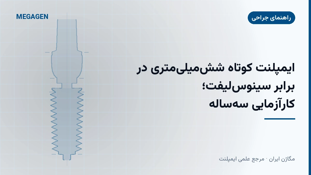 ایمپلنت کوتاه ششمیلیمتری در برابر سینوسلیفت؛ کارآزمایی سهساله