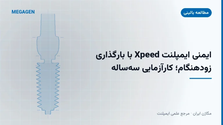 ایمنی ایمپلنت Xpeed با بارگذاری زودهنگام؛ کارآزمایی سهساله