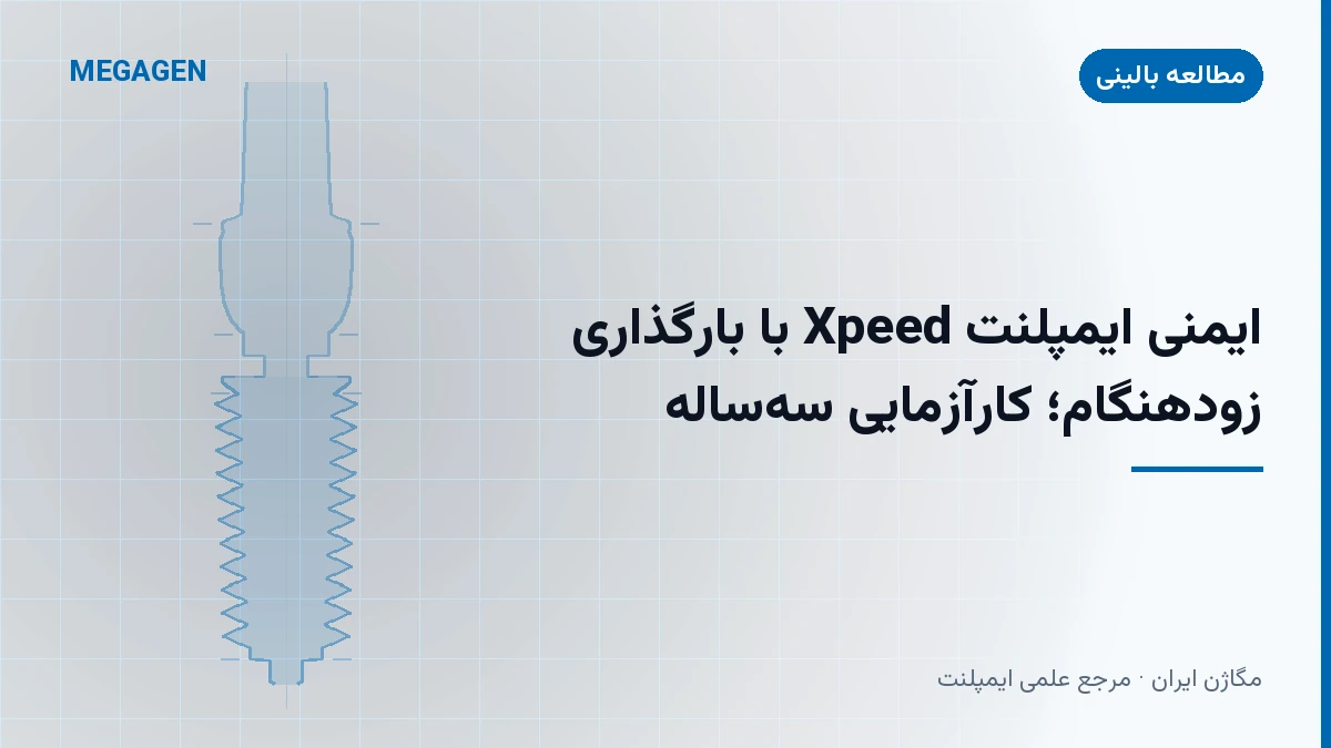 ایمنی ایمپلنت Xpeed با بارگذاری زودهنگام؛ کارآزمایی سه‌ساله