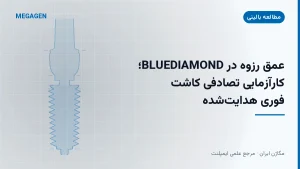 عمق رزوه در BLUEDIAMOND؛ کارآزمایی تصادفی کاشت فوری هدایت‌شده