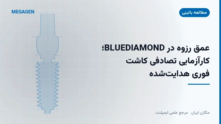 عمق رزوه در BLUEDIAMOND؛ کارآزمایی تصادفی کاشت فوری هدایتشده