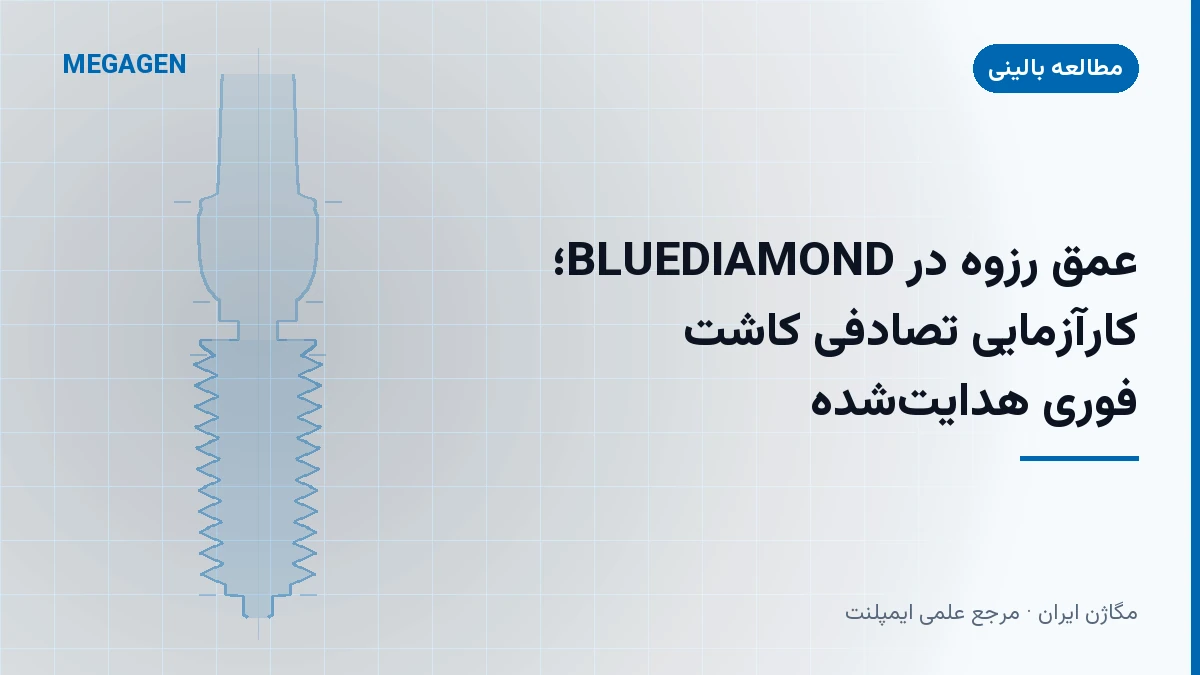 عمق رزوه در BLUEDIAMOND؛ کارآزمایی تصادفی کاشت فوری هدایتشده