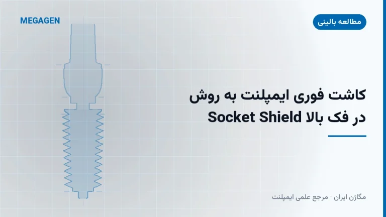 کاشت فوری ایمپلنت به روش Socket Shield در فک بالا