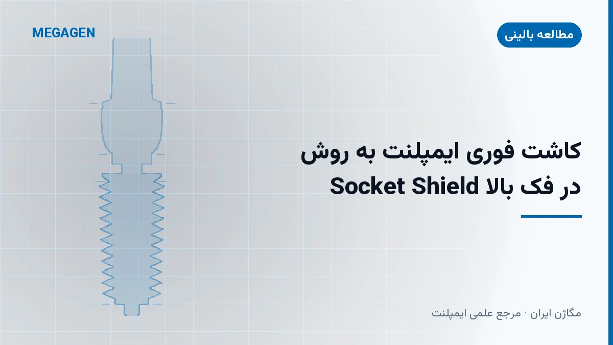کاشت فوری ایمپلنت به روش Socket Shield در فک بالا
