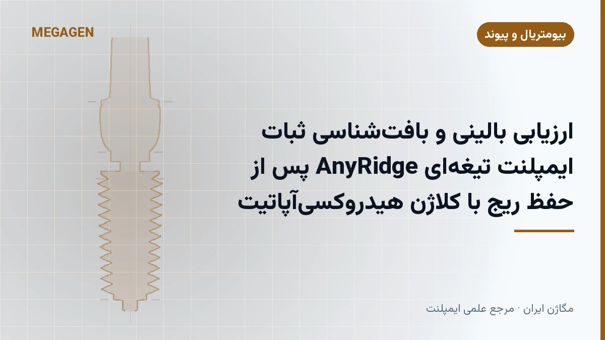 ارزیابی بالینی و بافت‌شناسی ثبات ایمپلنت تیغه‌ای AnyRidge پس از حفظ ریج با کلاژن هیدروکسی‌آپاتیت