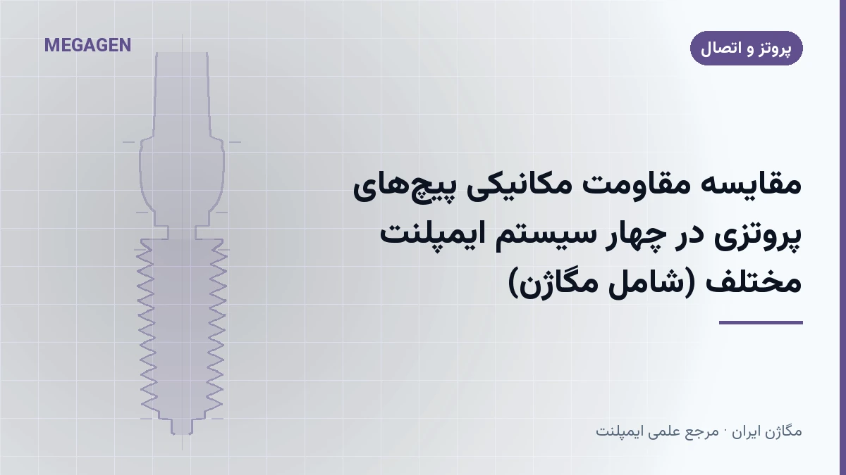 مقایسه مقاومت مکانیکی پیچ‌های پروتزی در چهار سیستم ایمپلنت مختلف (شامل مگاژن)