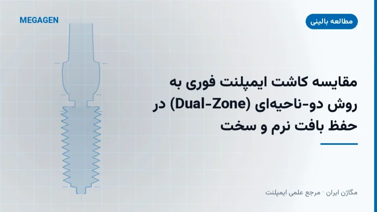 مقایسه کاشت ایمپلنت فوری به روش دو-ناحیهای (Dual-Zone) در حفظ بافت نرم و سخت