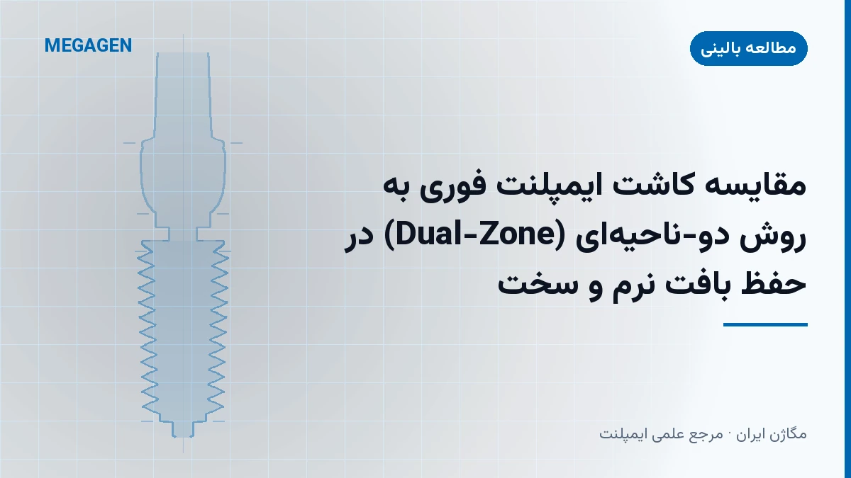 مقایسه کاشت ایمپلنت فوری به روش دو-ناحیه‌ای (Dual-Zone) در حفظ بافت نرم و سخت