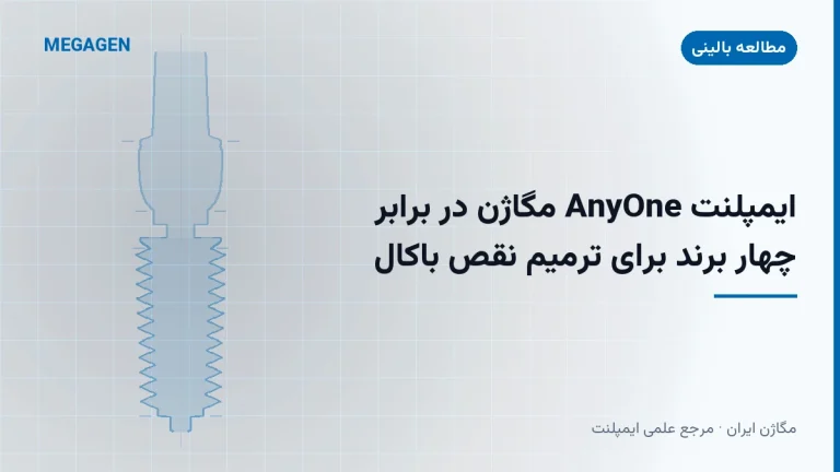 ایمپلنت AnyOne مگاژن در برابر چهار برند برای ترمیم نقص باکال