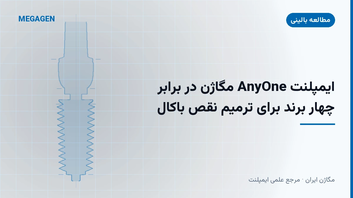 ایمپلنت AnyOne مگاژن در برابر چهار برند برای ترمیم نقص باکال