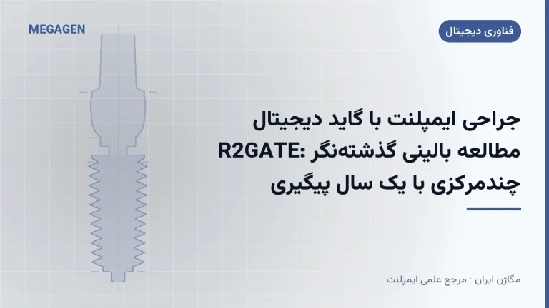 جراحی ایمپلنت با گاید دیجیتال R2GATE: مطالعه بالینی گذشتهنگر چندمرکزی با یک سال پیگیری