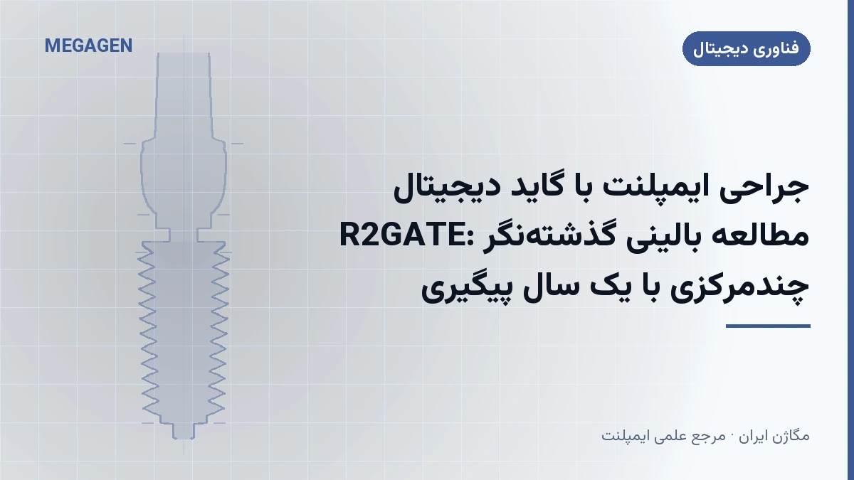 جراحی ایمپلنت با گاید دیجیتال R2GATE: مطالعه بالینی گذشته‌نگر چندمرکزی با یک سال پیگیری