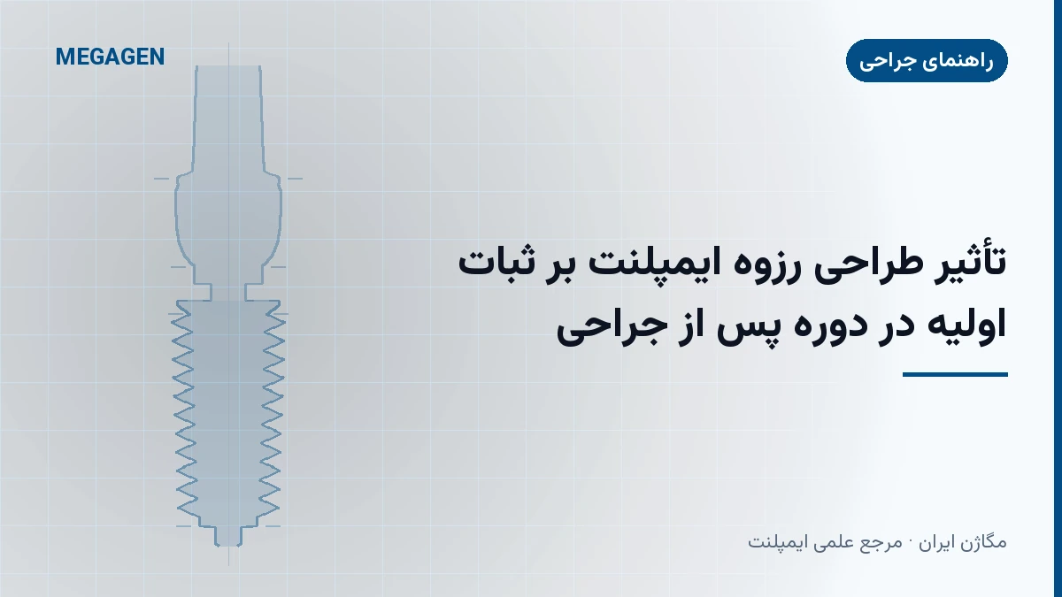 تأثیر طراحی رزوه ایمپلنت بر ثبات اولیه در دوره پس از جراحی