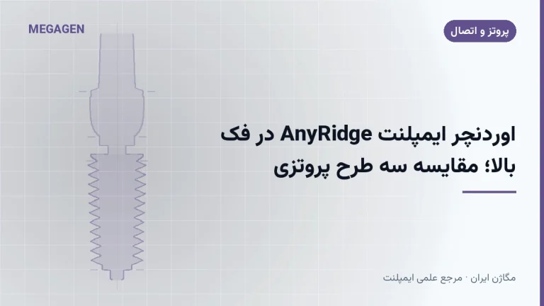 اوردنچر ایمپلنت AnyRidge در فک بالا؛ مقایسه سه طرح پروتزی
