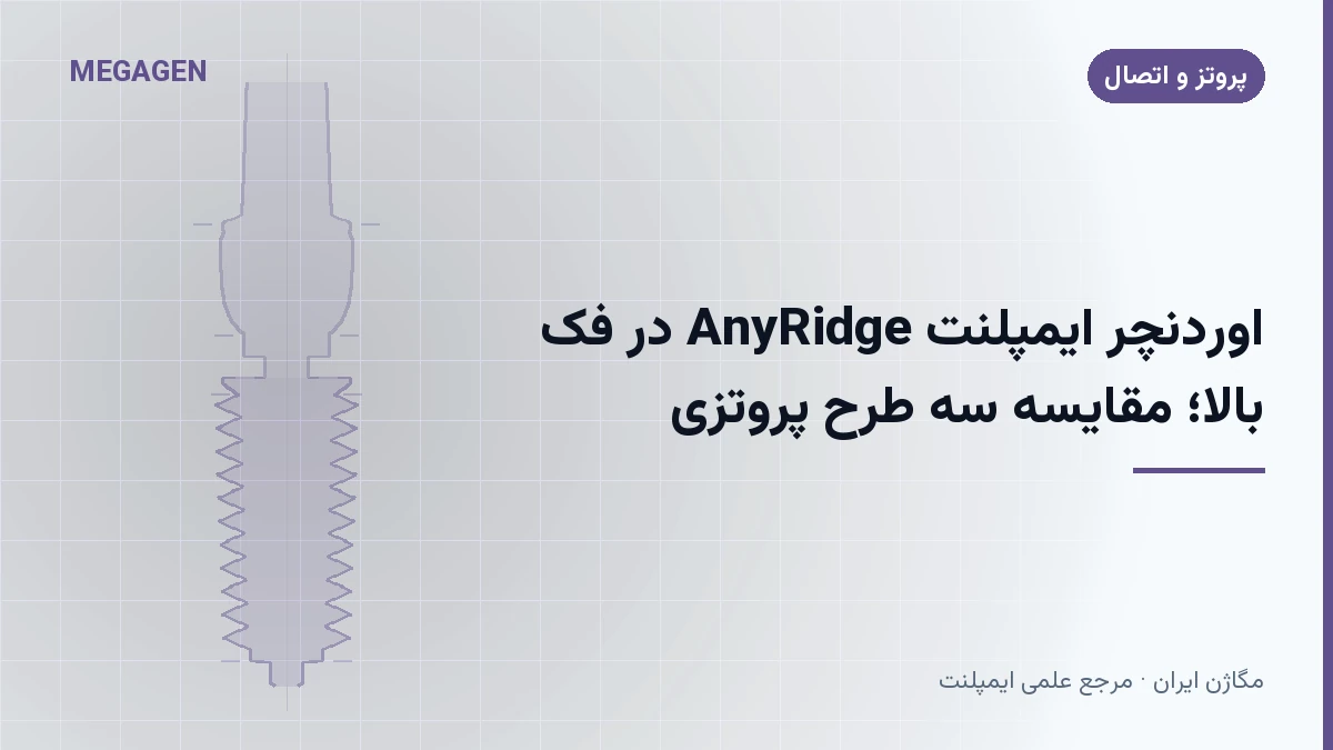 اوردنچر ایمپلنت AnyRidge در فک بالا؛ مقایسه سه طرح پروتزی