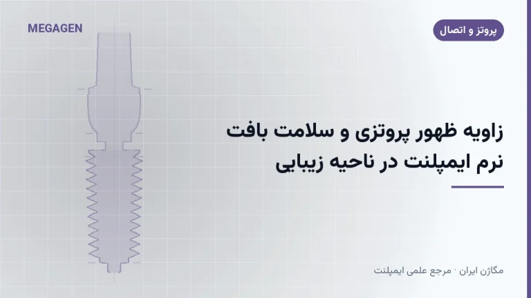 زاویه ظهور پروتزی و سلامت بافت نرم ایمپلنت در ناحیه زیبایی
