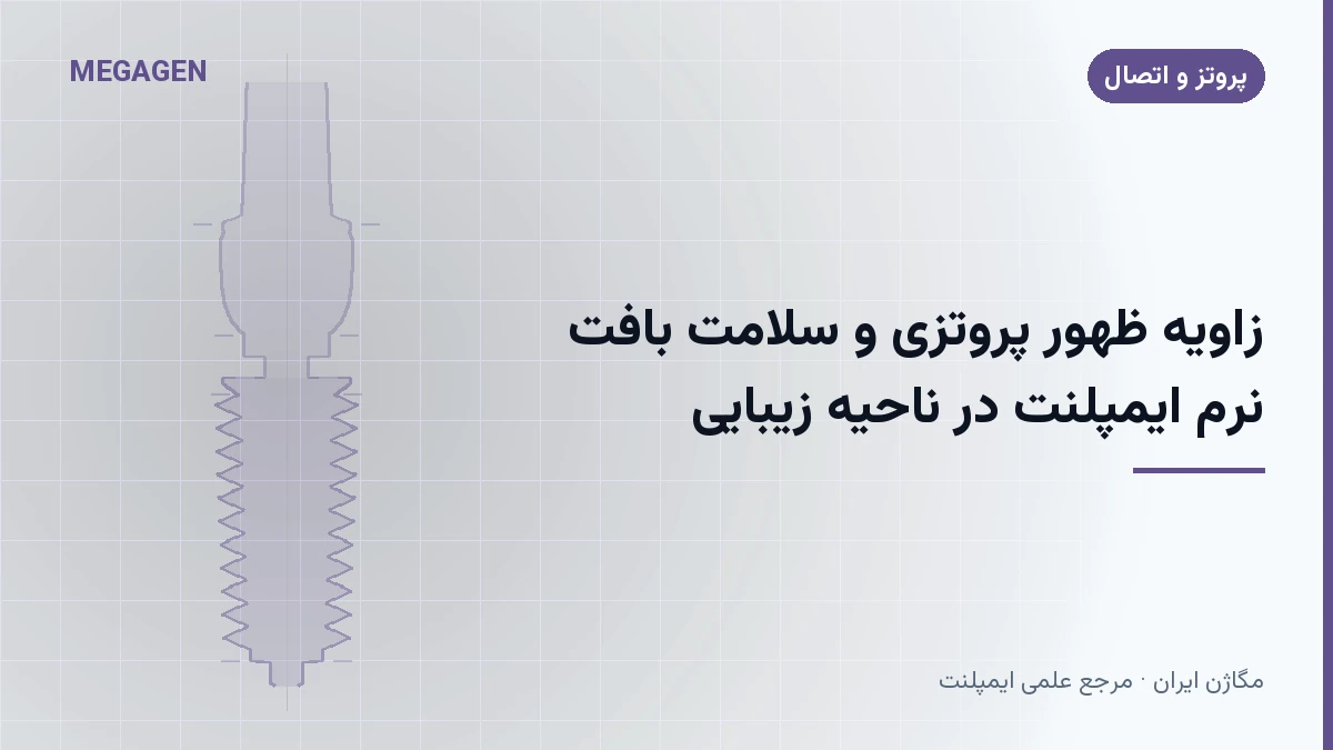 زاویه ظهور پروتزی و سلامت بافت نرم ایمپلنت در ناحیه زیبایی
