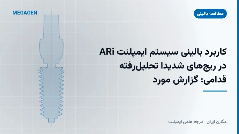 کاربرد بالینی سیستم ایمپلنت ARi در ریجهای شدیداً تحلیلرفته قدامی: گزارش مورد