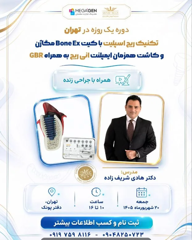 ریج اسپلیت با کیت Bone Ex؛ کاشت همزمان AnyRidge و GBR